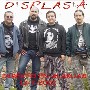 Displasia